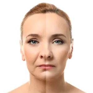 Anti-Aging & Wrinkles